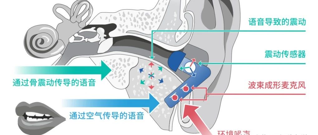 应用于TWS耳机的DSP语音捕捉技术_Alango